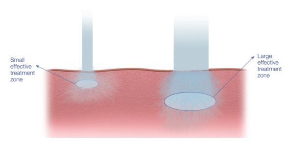 63db28eeeff59e28e317f568