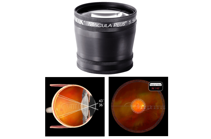 30D - Indirect BIO Lenses - Diagnostic Lenses