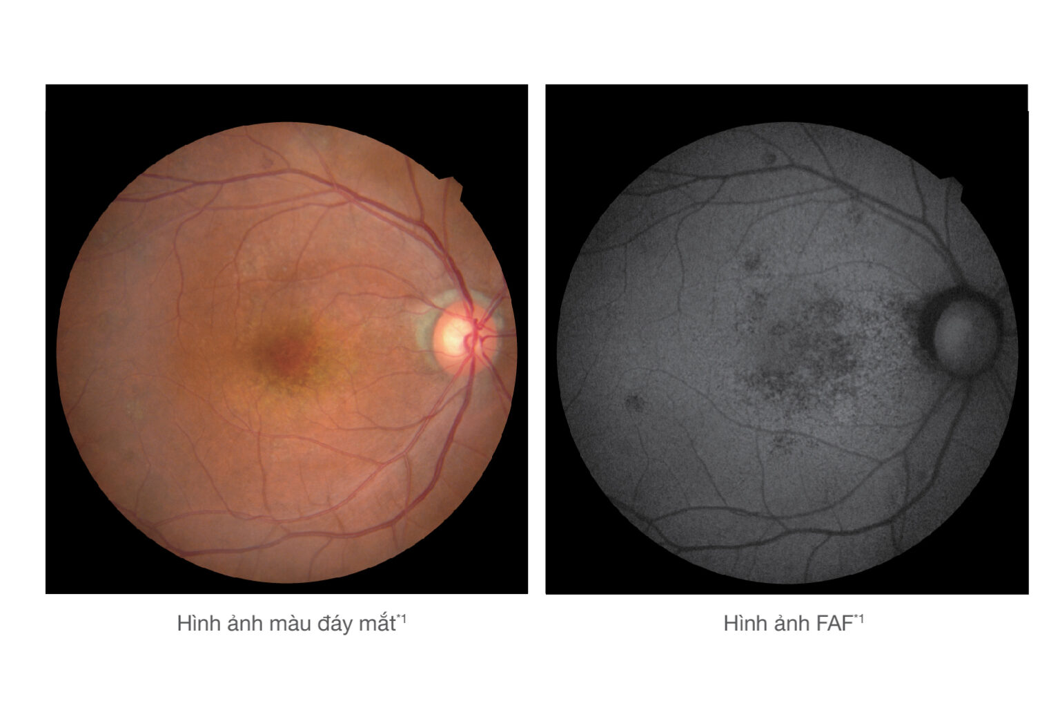 Retina Scan Duo™ 2 | Công ty Cổ phần TM&DV Việt Can