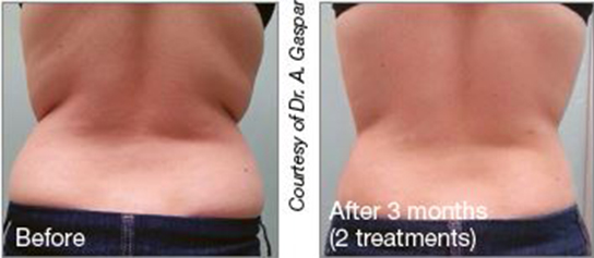 63eaf9685d7ce60c44f97c11