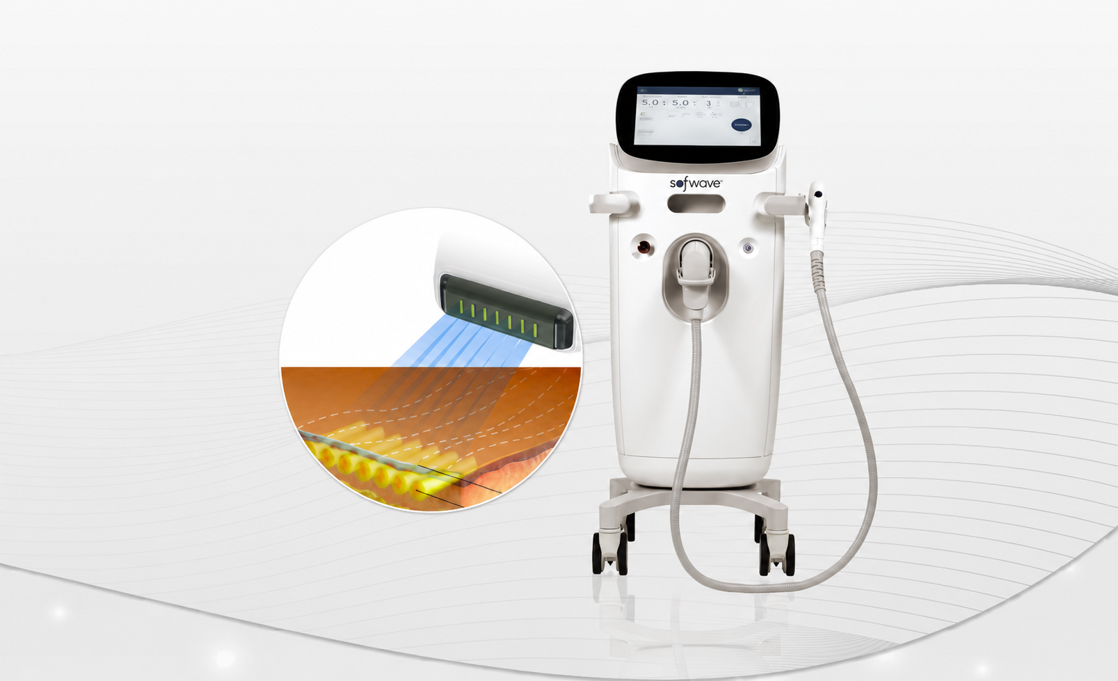 Cơ chế hoạt động của Sofwave 