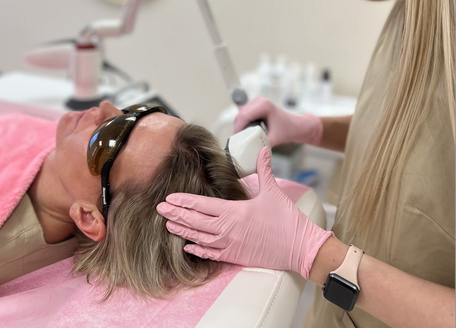 Công nghệ laser trong điều trị rụng tóc